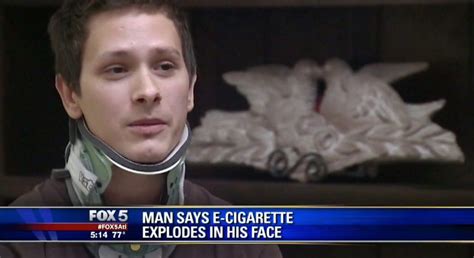 Image result for Vape Exploding News