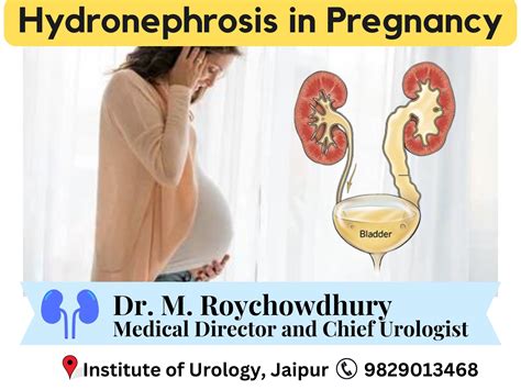 Causes Of Hydronephrosis