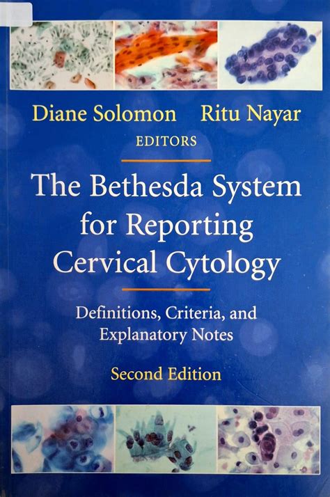 Buy The Bethesda System for Reporting Cervical Cytology (Second Edition ...
