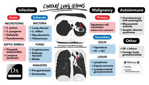 Dx schema – Lung Cavity – The Clinical Problem Solvers