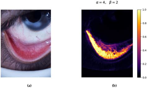 Novel Biased Normalized Cuts Approach for the Automatic Segmentation of ...