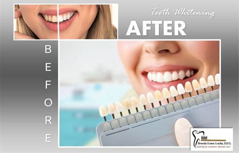 Image result for Expect Tutorial