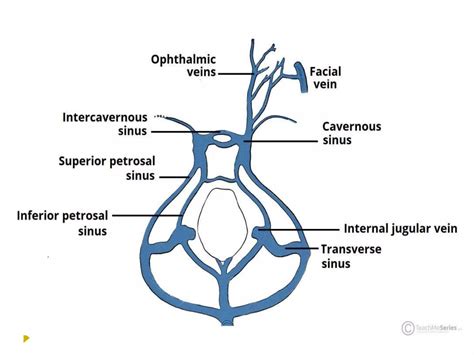 Carotid Cavernous Fistula | PPTX