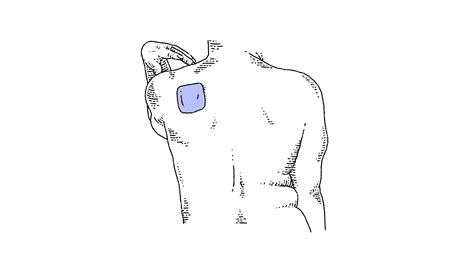 How To Put On An Estrogen Patch at David Velasquez blog