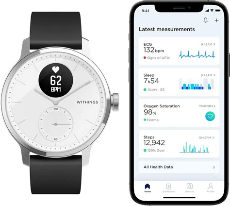 Buy Withings ScanWatch - Hybrid Smartwatch & Activity Tracker with ...