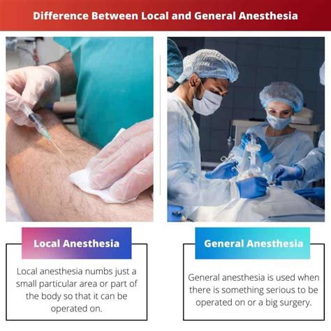 Difference Between Local General Anesthesia 的图像结果