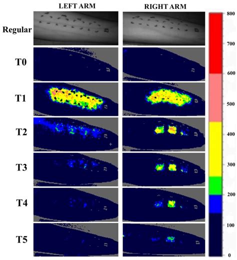 Influence of Moisturizers on Skin Microcirculation: An Assessment Study ...