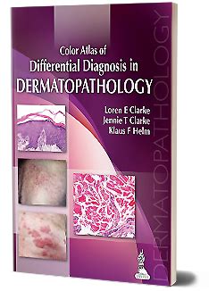 JaypeeDigital | Adnexal Neoplasms