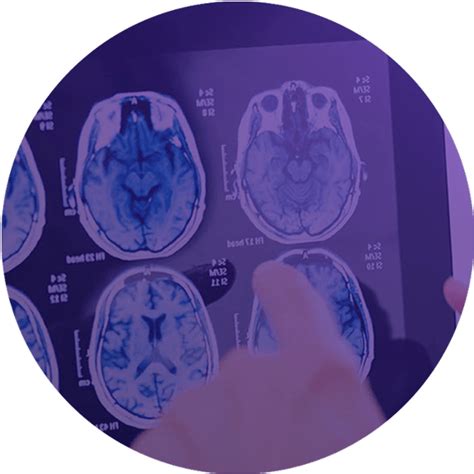 Image result for PACS System Tutorial