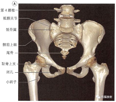 《矫形外科原则》读书笔记（三）-股骨额状面畸形的CORA分析 - 知乎