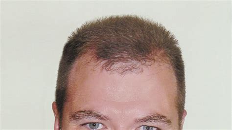 Image result for Tim Root Refraction