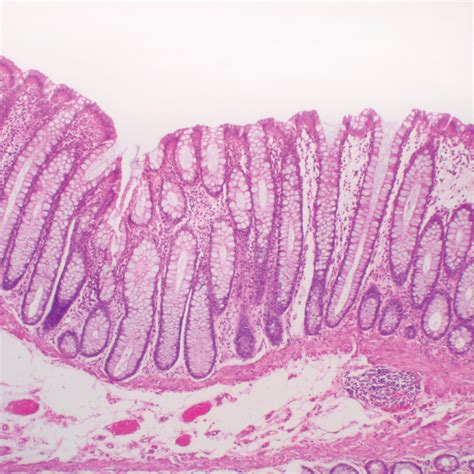 Duodenum Histology Diagram | Quizlet