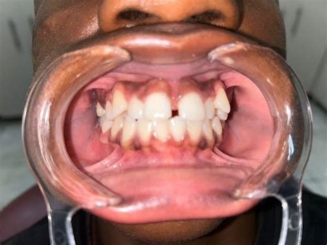 Image result for Operative Dentistry