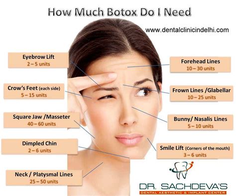 How Do Botox Works 的图像结果