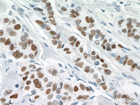 GATA3 antibody (66400-1-Ig) | Proteintech