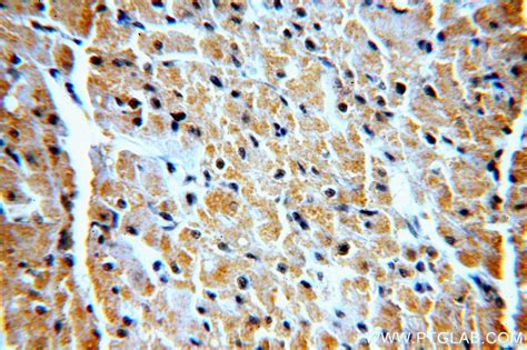 VPS34 antibody (13723-1-AP) | Proteintech