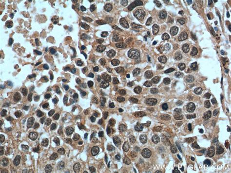 GSK3B antibody (22104-1-AP) | Proteintech