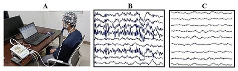 Effects of Sleep Deprivation on Functional Connectivity of Brain ...