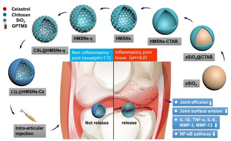 Intra-Articular Drug Delivery for Osteoarthritis Treatment