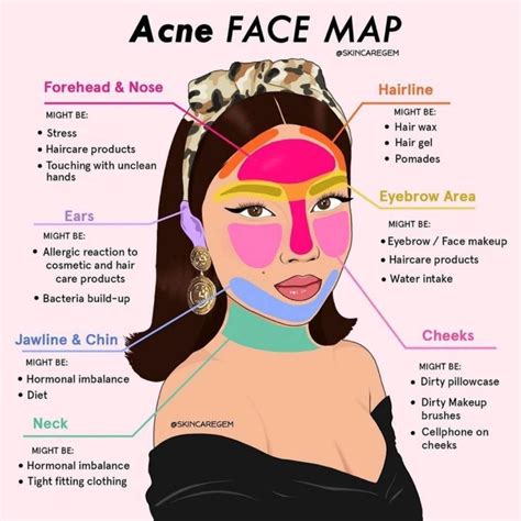 Acne face mapping what your skin is trying to tell you – Artofit