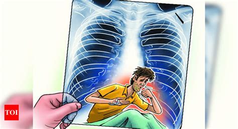 Mumbai: ‘Access to new drugs to treat tuberculosis still poor’ | Mumbai ...