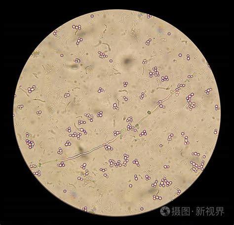 3個月內致命的超級真菌：耳念珠菌-Hello醫師