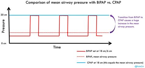 Image result for CPAP and BiPAP Graph