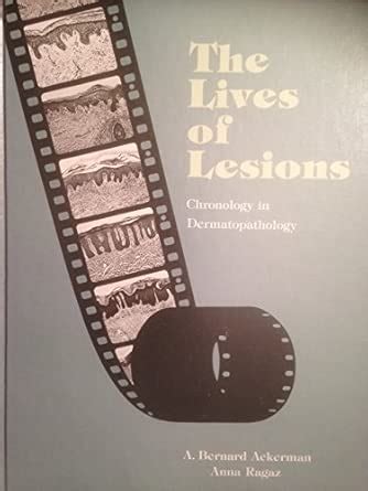 Buy Lives of Lesions Book Online at Low Prices in India | Lives of ...