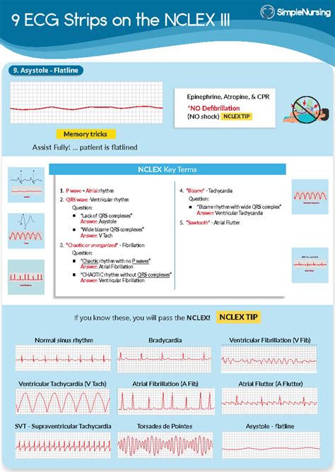 3. 9 ECG Strips on the Nclex - 9 ECG Strips on the NCLEX III 3. Normal sinus rhythm Ventricular ...