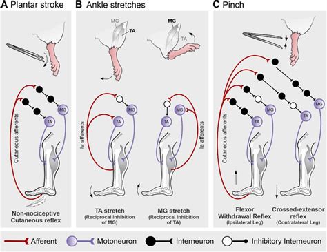 Image result for Crossed Extensor Reflex Demonstration