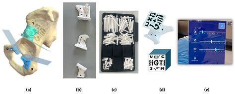 Feasibility and Accuracy of a Dual-Function AR-Guided System for PSI ...