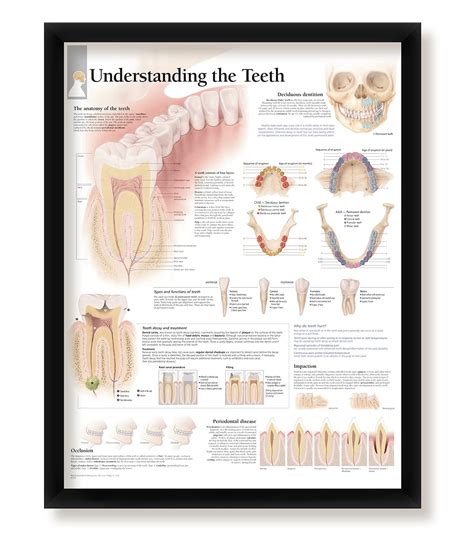 Buy Understanding Teeth, Wall Decor , Framed Educational Art for ...