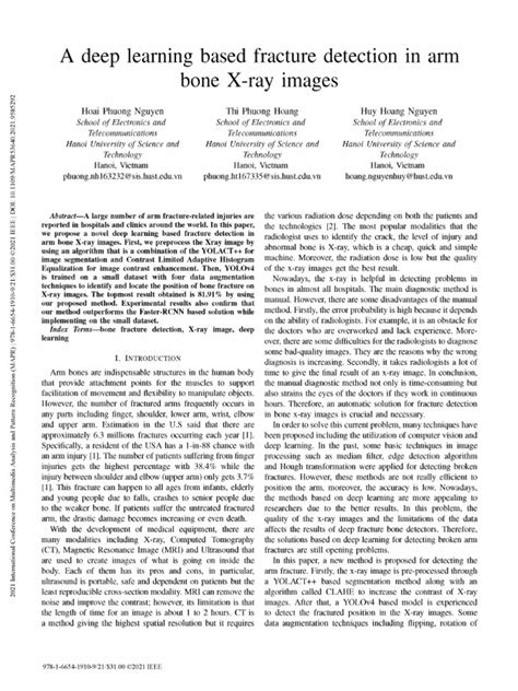 Bone Fracture Detection Using Image Processing Source Code GitHub 的图像结果