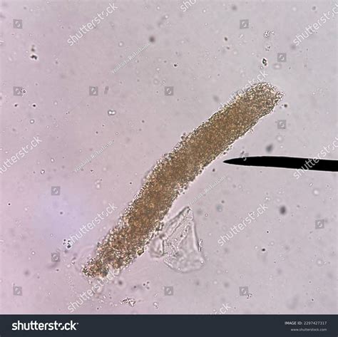 2+ Hundred Granular Casts Royalty-Free Images, Stock Photos & Pictures ...