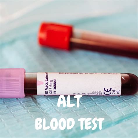 Alanine Transaminase ALT Blood Test - bigman lab