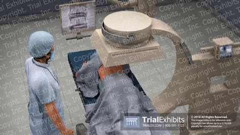 Image result for Myogram