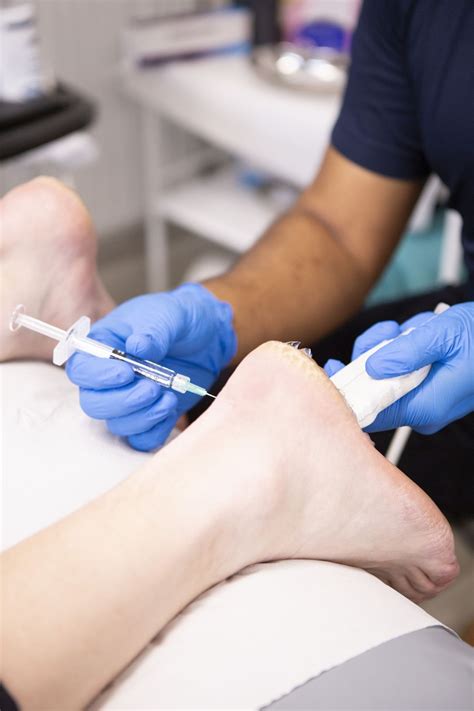 Injection Shot 的图像结果