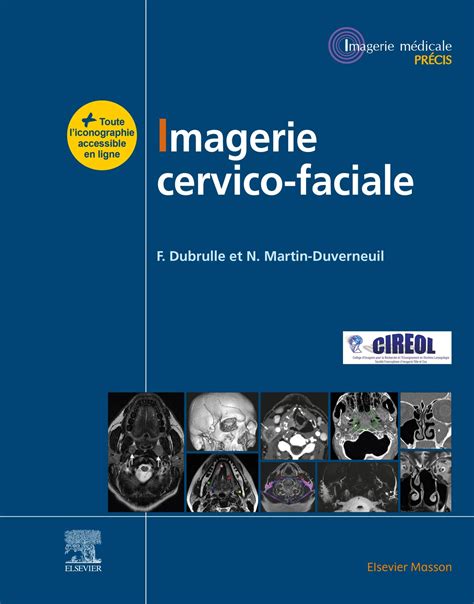 Buy Imagerie cervicofaciale: Massif facial - Sinus - Voies ...