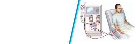 How to manage calcium phosphorus metabolism in CKD patients?