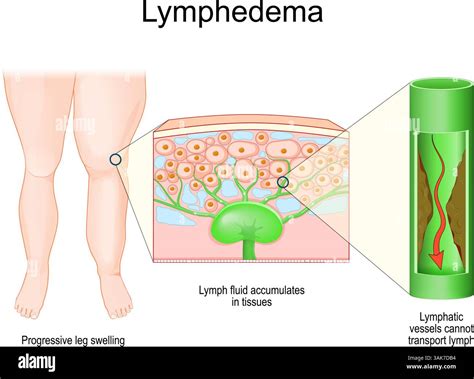 Leg Lymphatic System: Lymphatic Drainage – EXGB
