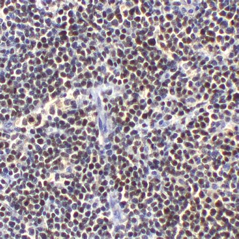 SOX11 - CL0142 | PathnSitu Biotechnologies