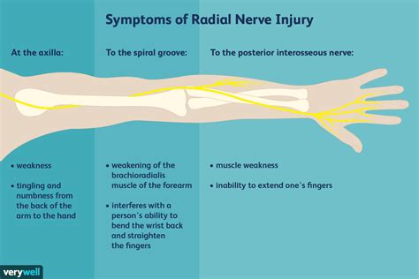 Image result for horsetail and nerve damage