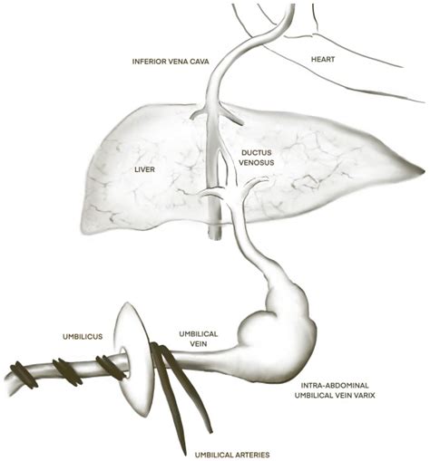 Umbilical Vein
