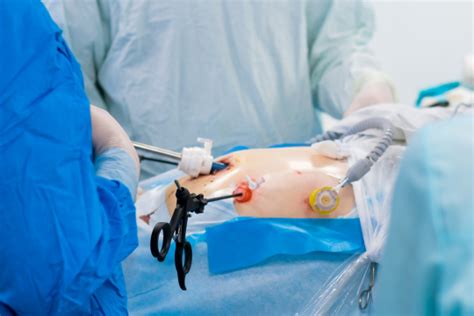 Surgery 的图像结果