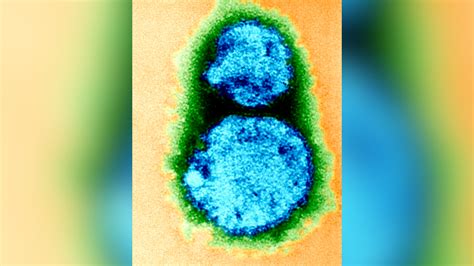 Why Is Hantavirus Rare