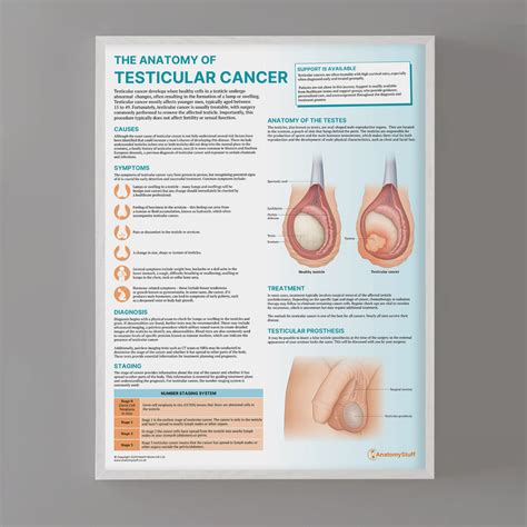 Testis Cancer Photos