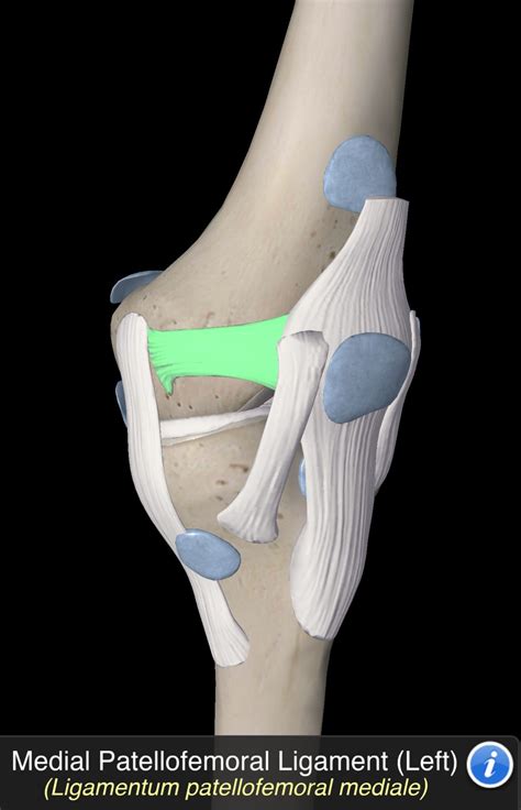 Medial Patellofemoral Ligament