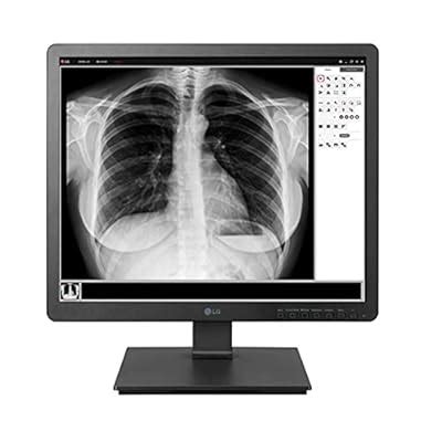 LG 19HK312C-B 19 Clinical Review Monitor, 1.3MP HD India | Ubuy