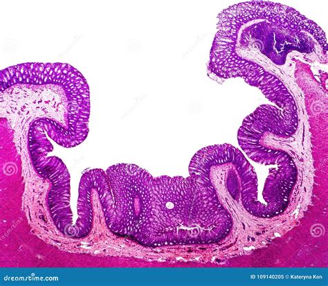 Histology of Human Appendix, Micrograph Showing Crypts of Lieberkuhn ...