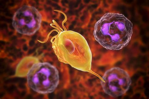 CE Activity | Trichomoniasis | Nurses
